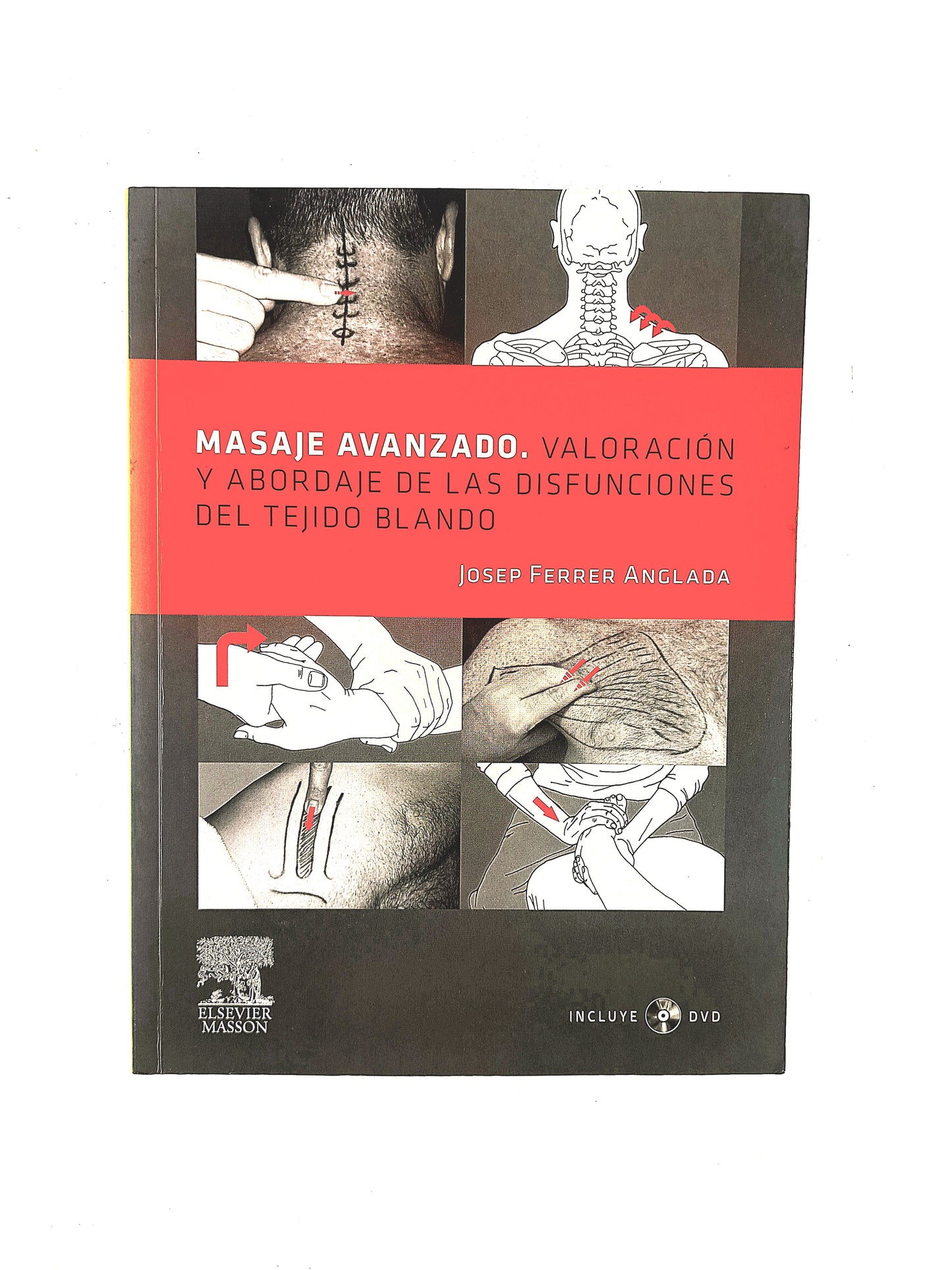 Masaje avanzado. Valoración y abordaje de las disfunciones del tejido blando