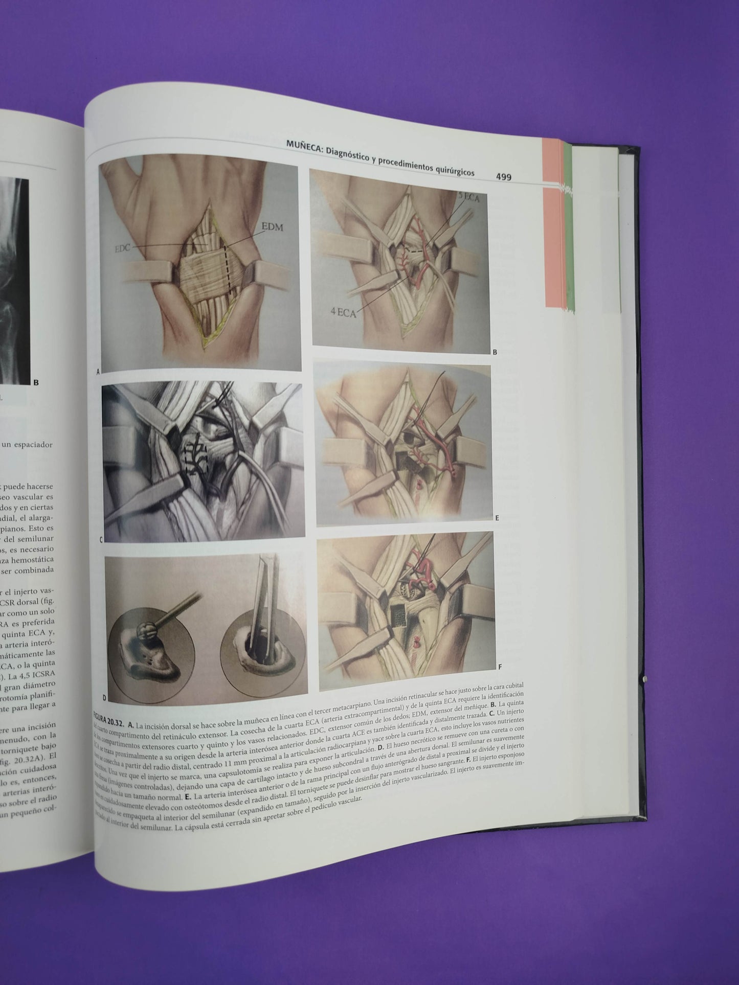 Muñeca diagnóstico y procedimientos quirúrgicos 2 edición volumen I Y II