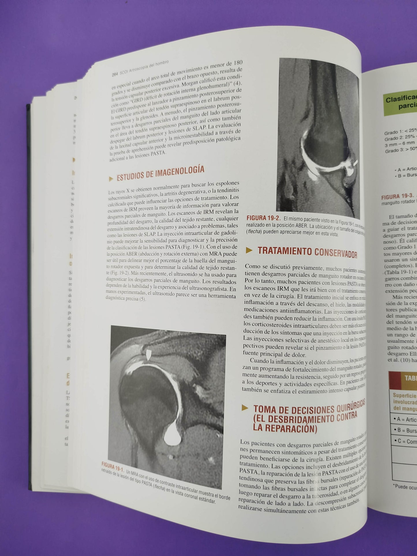 Artroscopia del hombro tercera edición