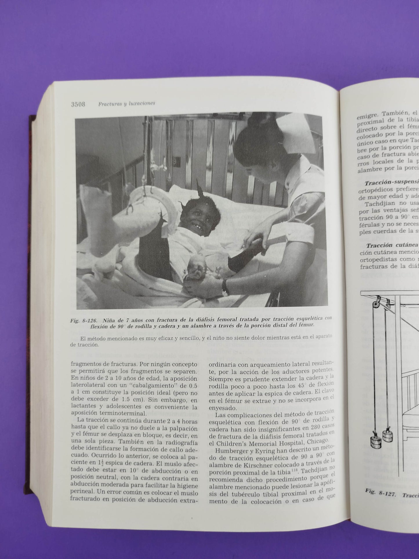 Ortopedia pediátrica segunda edición 4 tomos