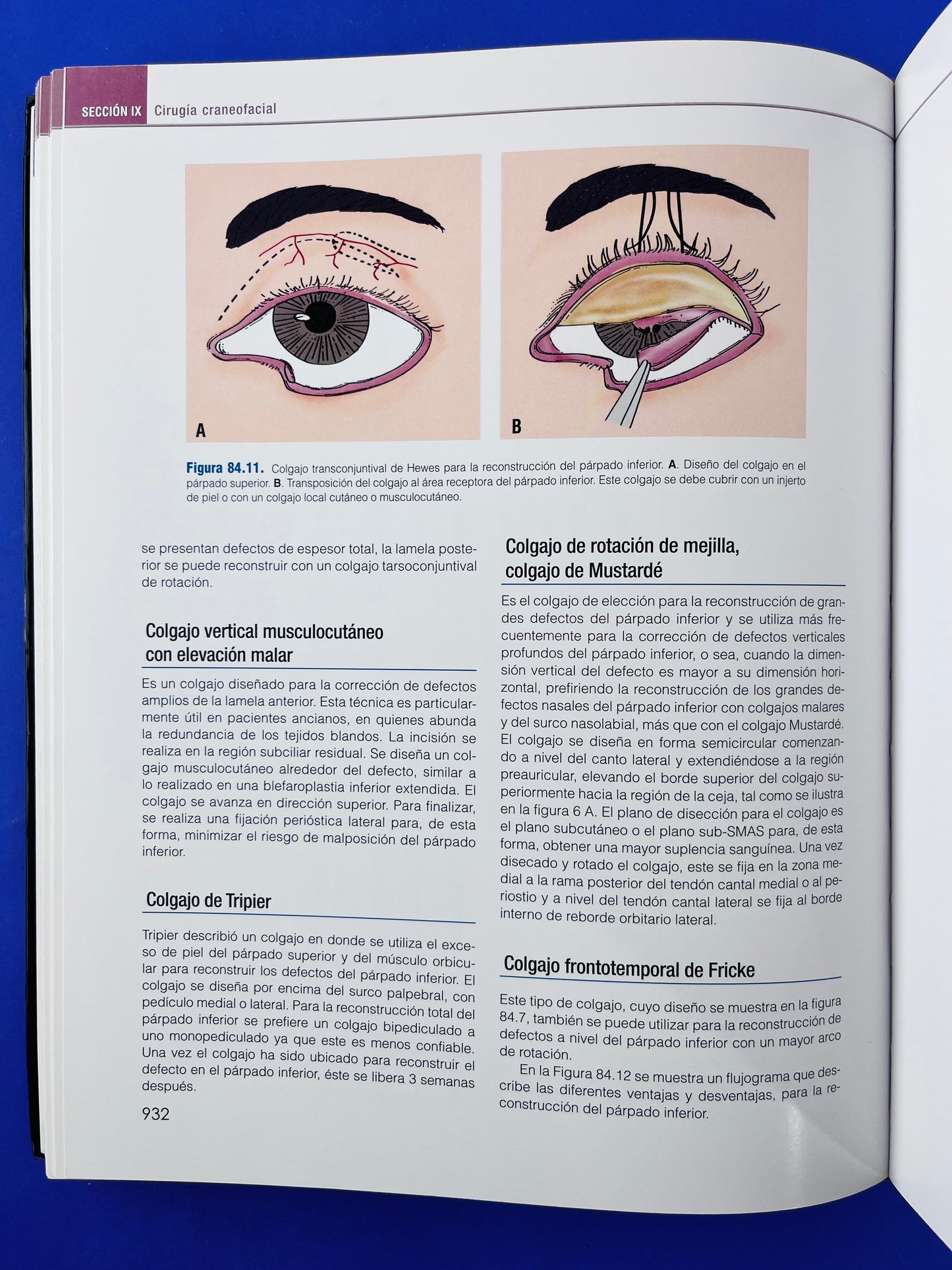 Cirugía plástica, reconstructiva y estética cirugía craneofacial cuarta edición tomo III