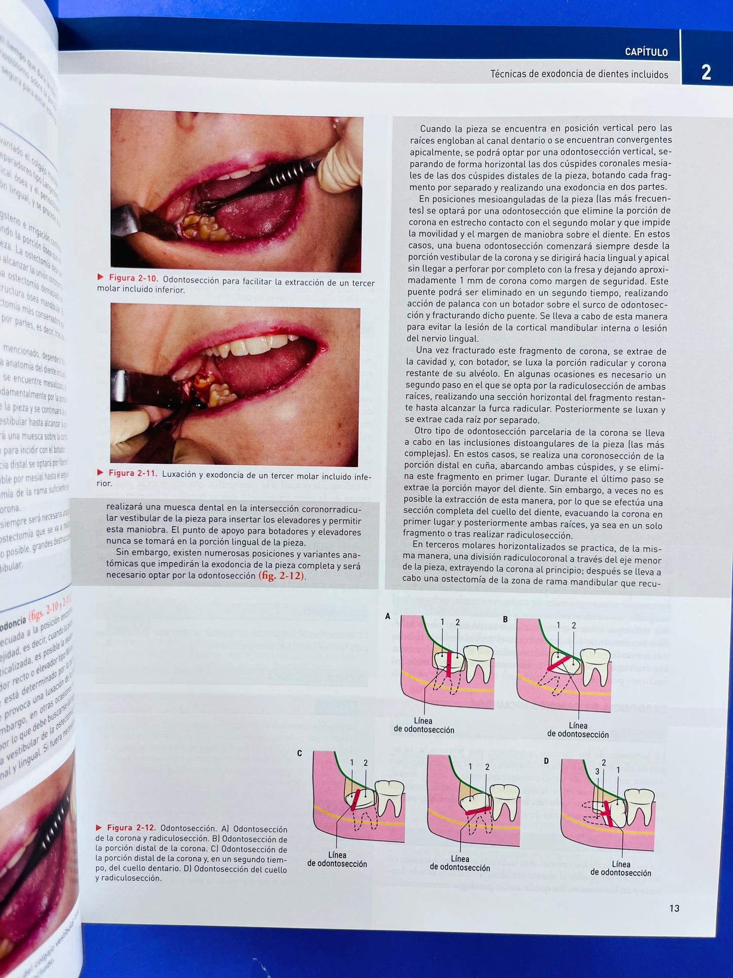 Cirugía Oral y Maxilofacial atlas de procedimientos y técnicas quirúrgicas