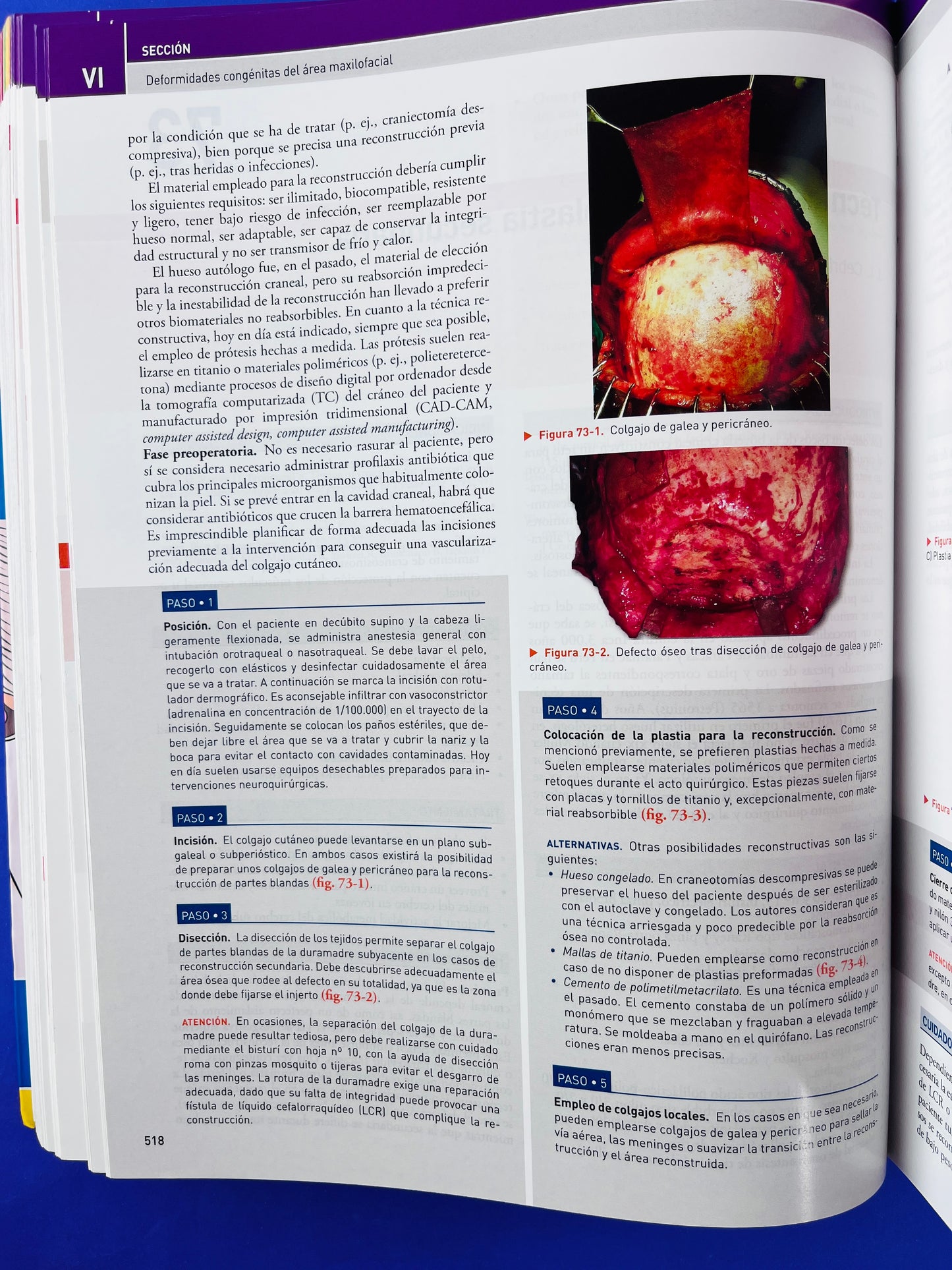 Cirugía Oral y Maxilofacial atlas de procedimientos y técnicas quirúrgicas