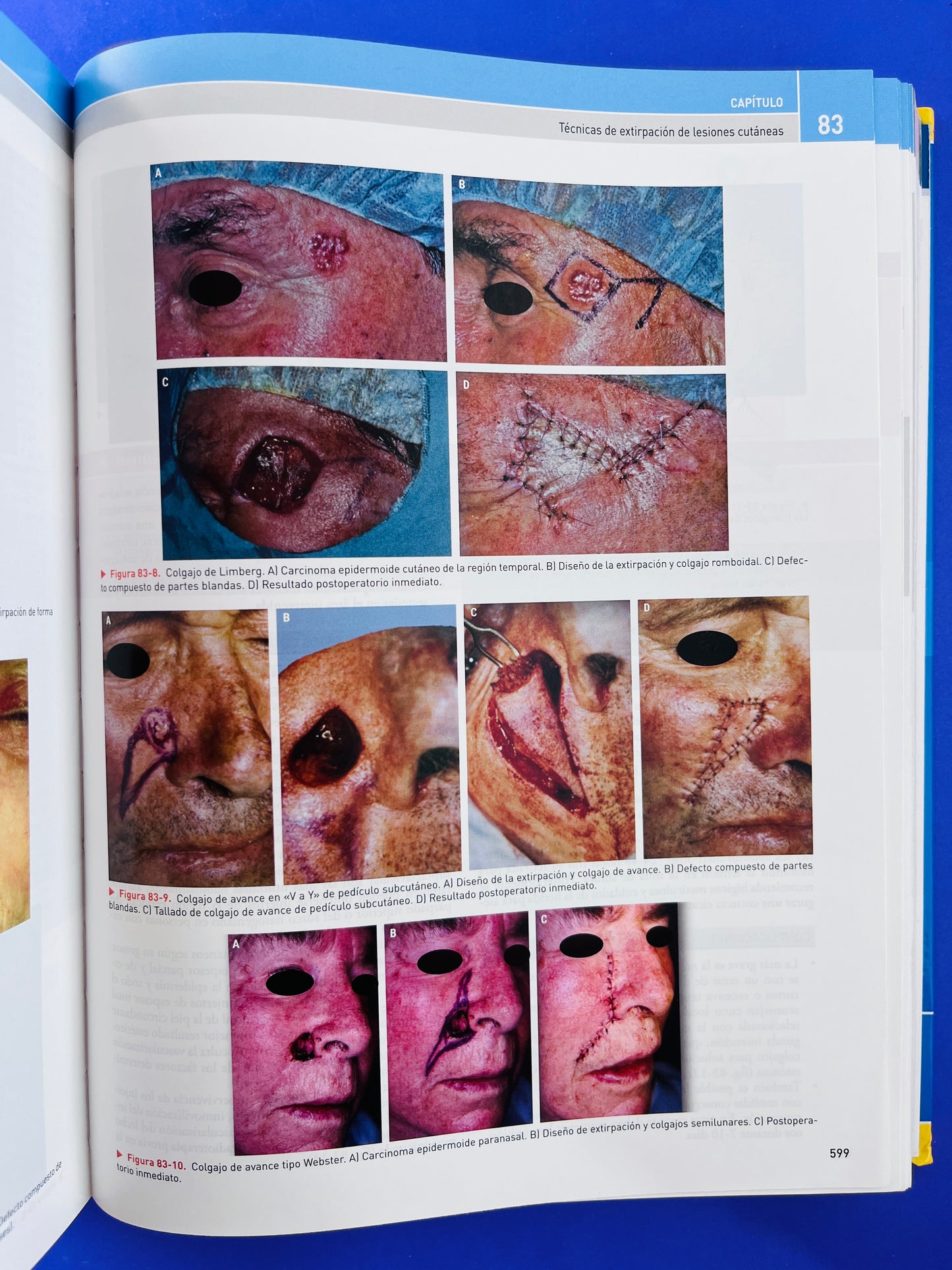 Cirugía Oral y Maxilofacial atlas de procedimientos y técnicas quirúrgicas