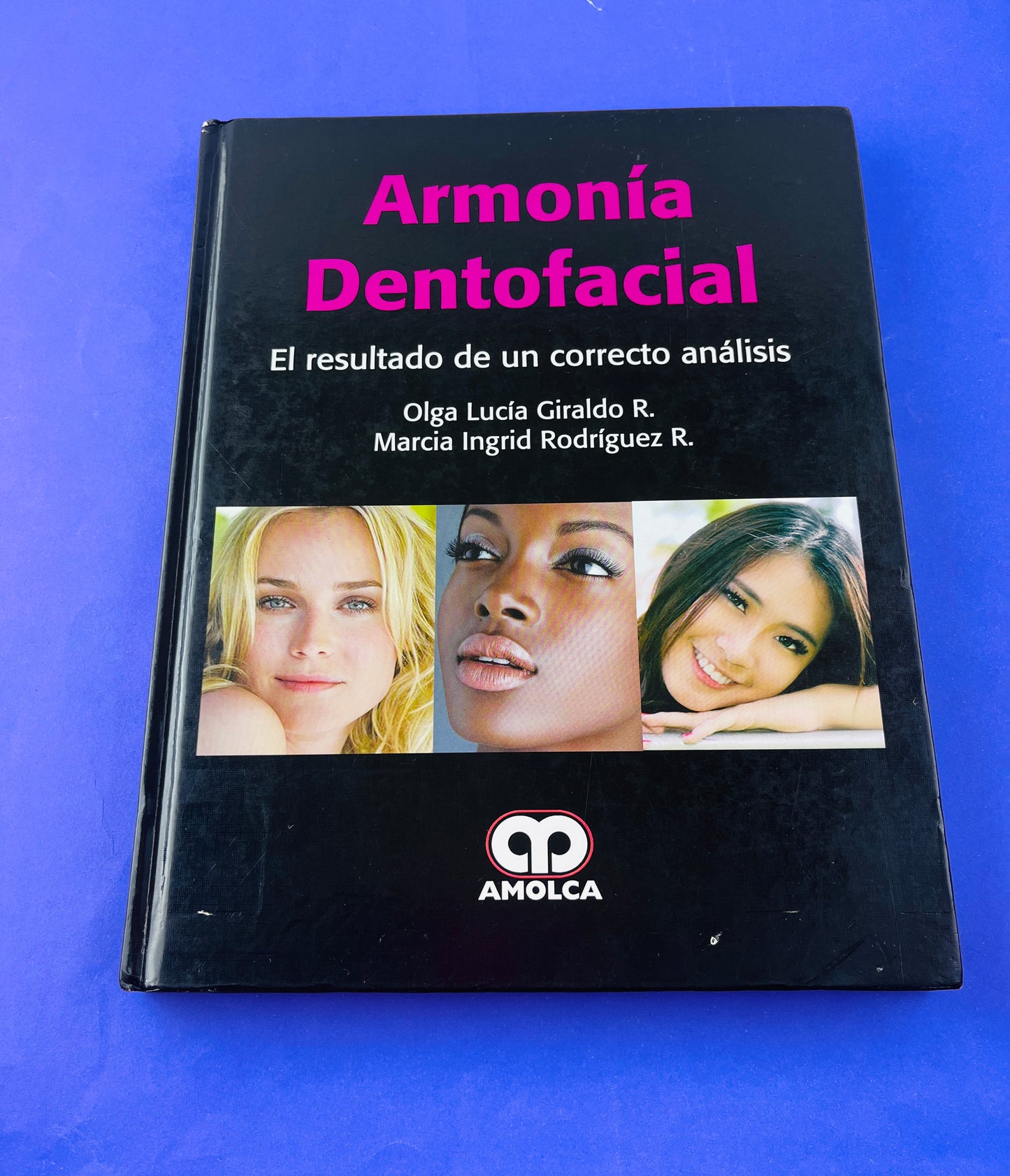 Armonía Dentofacial el resultado de un correcto análisis