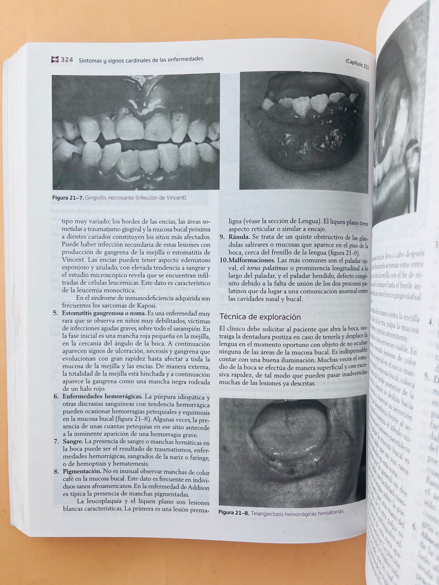 Síntomas y signos cardinales de las enfermedades 7a edición