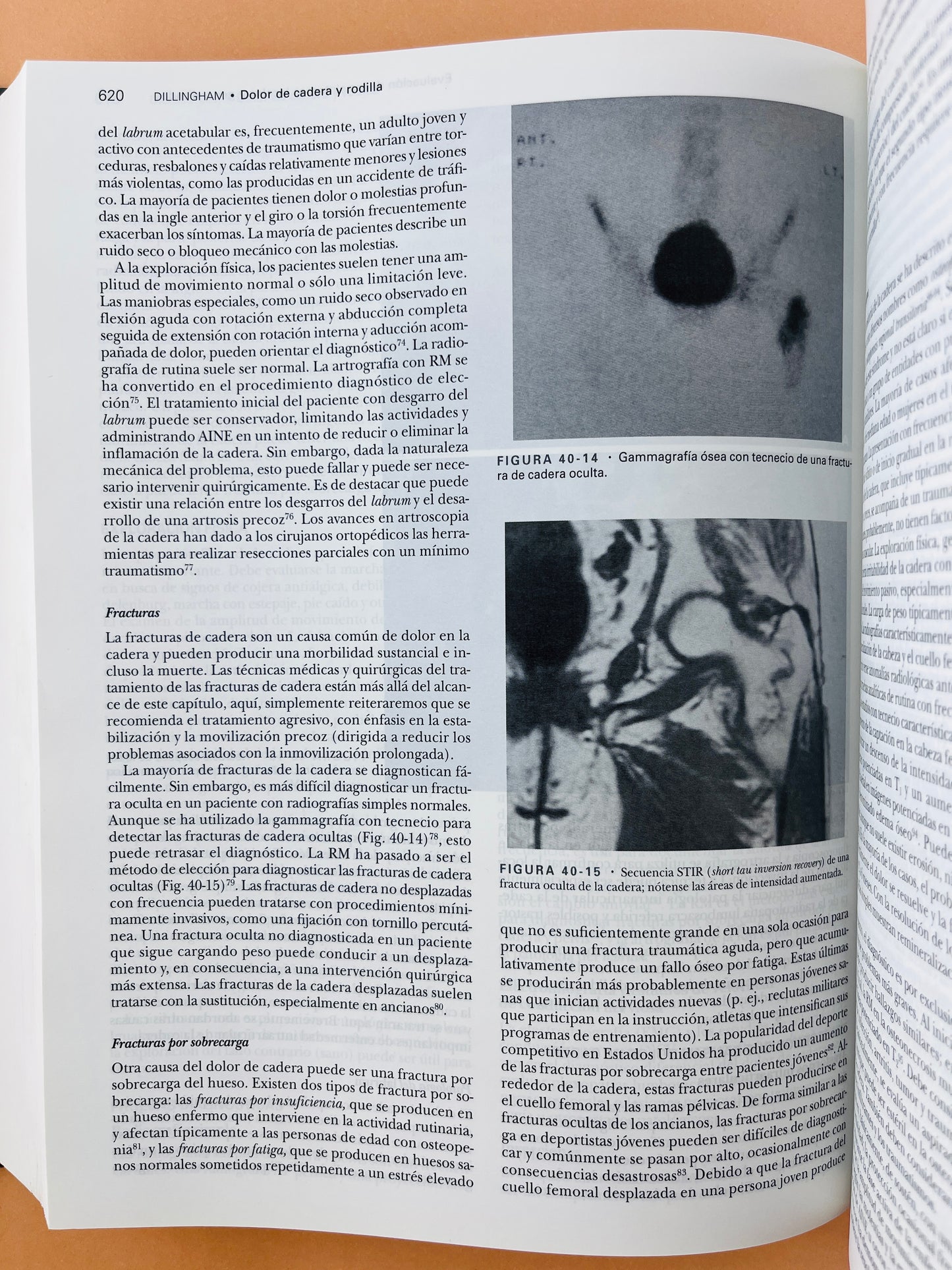 Kelley tratado de Reumatología séptima edición 2 tomos