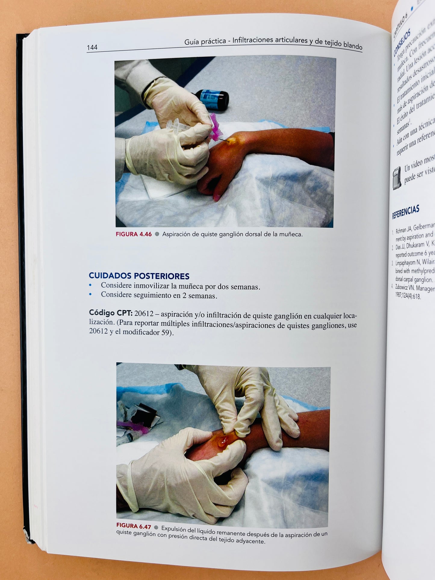 Guía práctica Infiltraciones Articulares y de tejido blando tercera edición