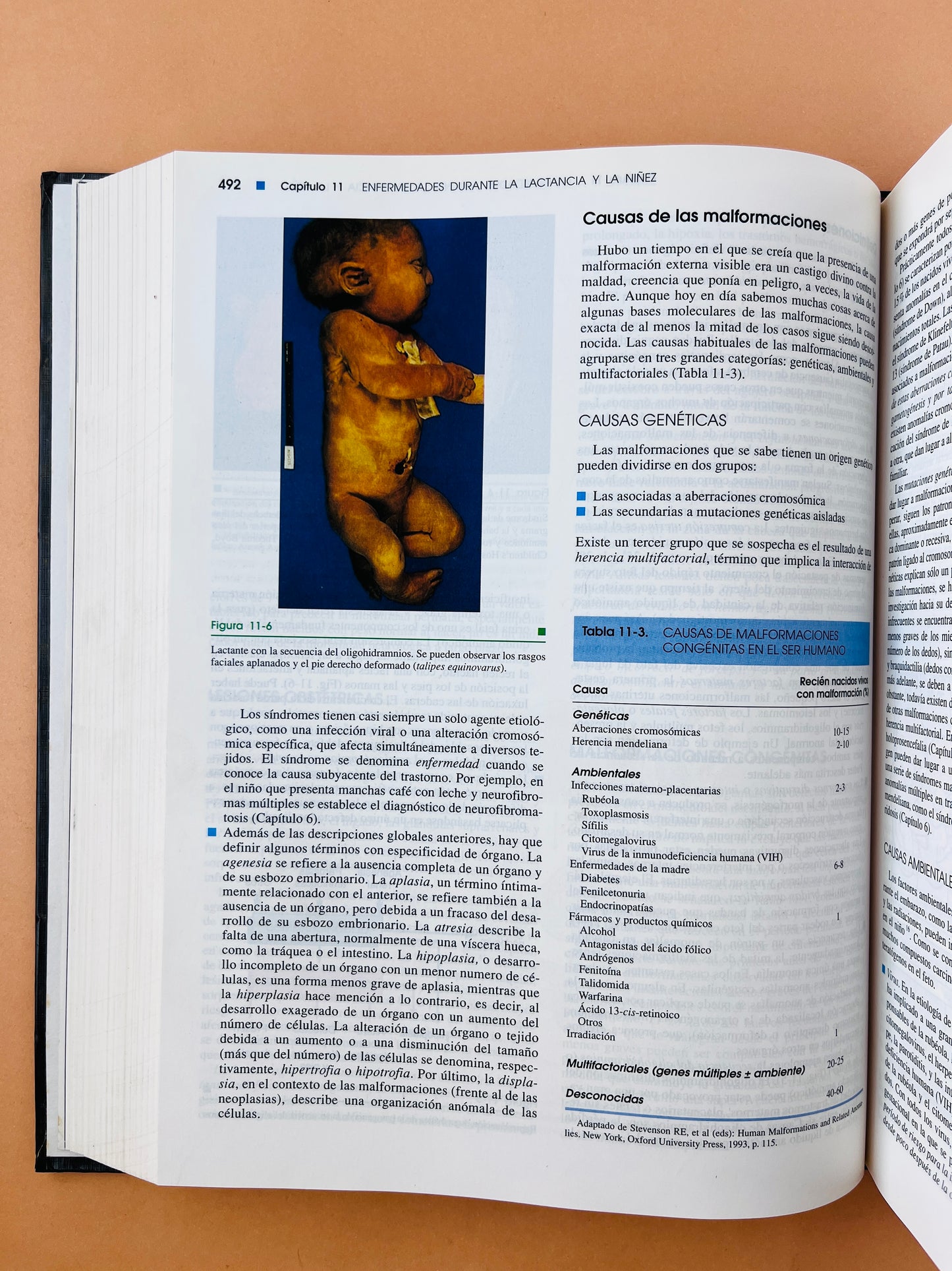 Robbins Patología estructural y funcional sexta edición