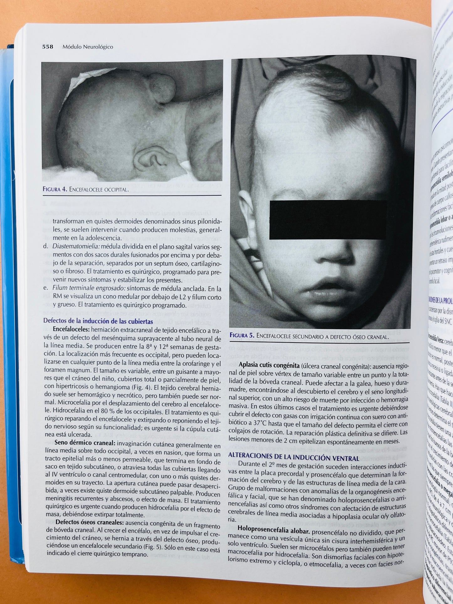 Urgencias y tratamiento de niño grave 2 volumenes