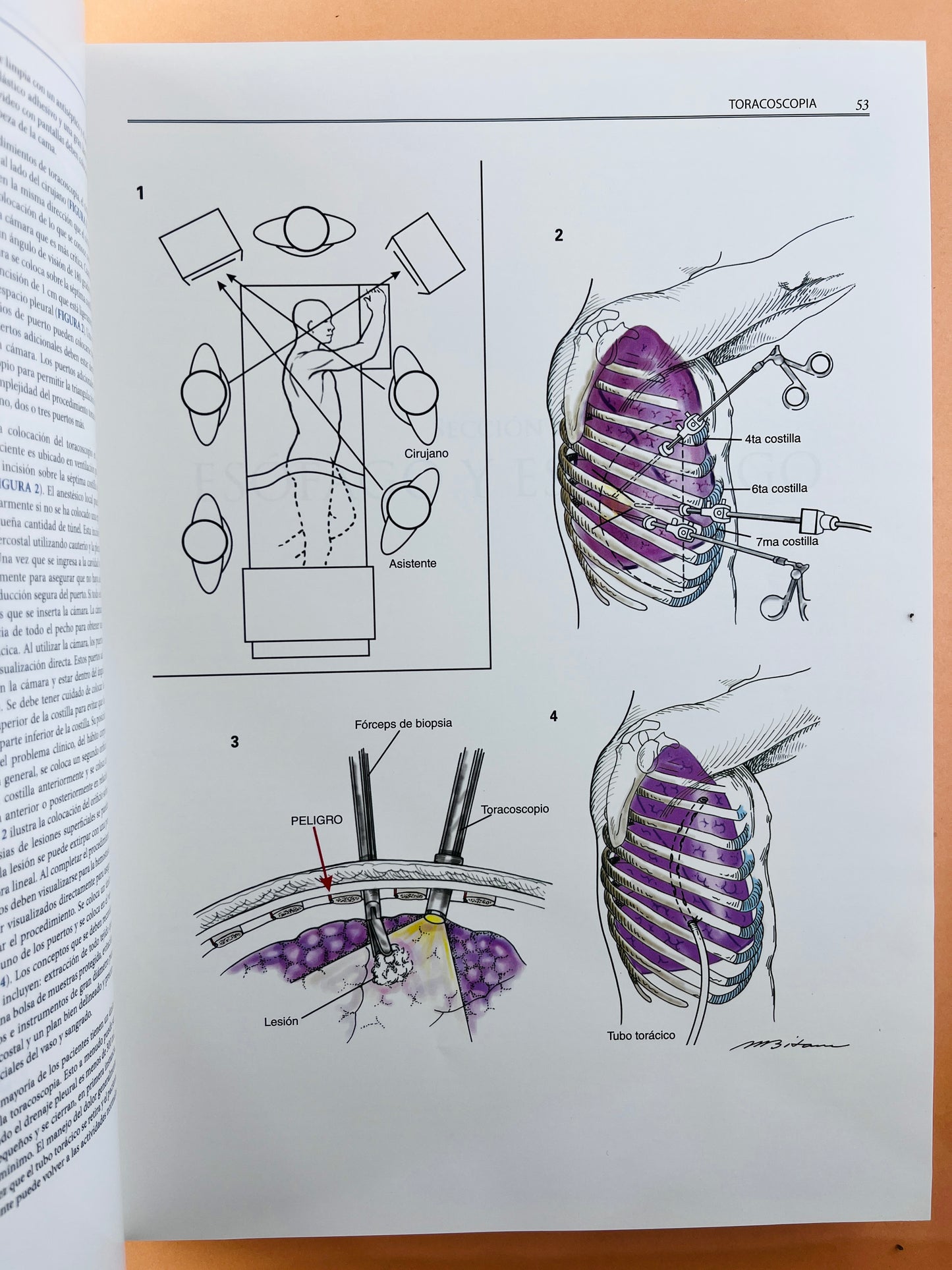 Zollinger´s Atlas de Operaciones Quirúrgicas décima edición