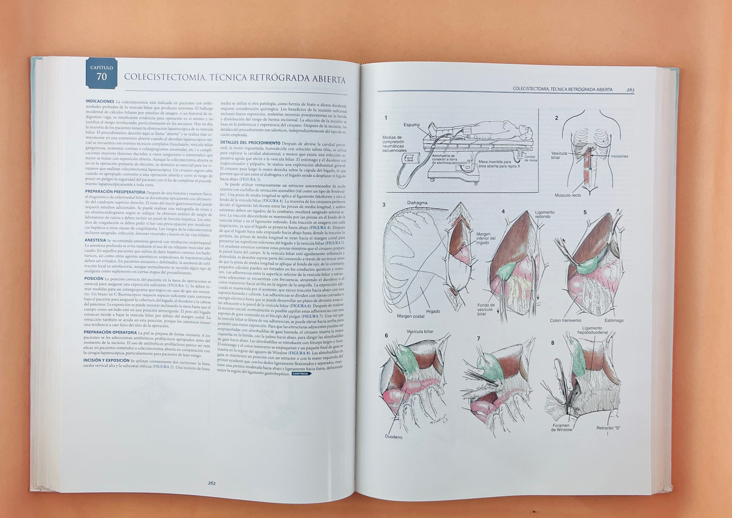 Zollinger´s Atlas de Operaciones Quirúrgicas décima edición