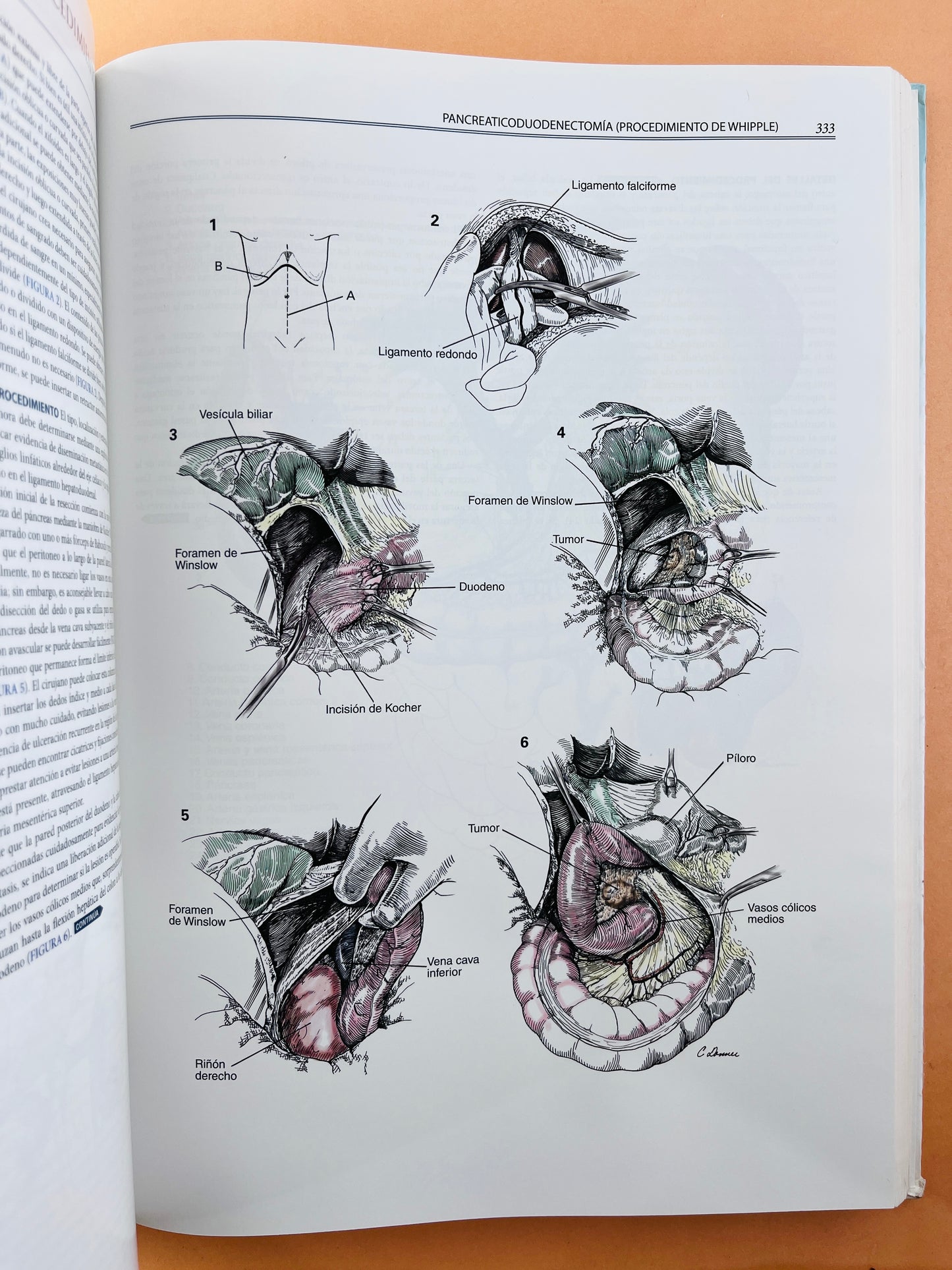 Zollinger´s Atlas de Operaciones Quirúrgicas décima edición