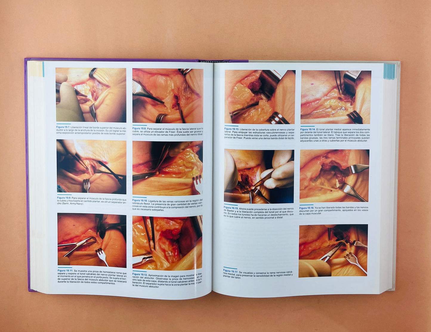 Técnicas en cirugía Ortopédica Pie y Tobillo