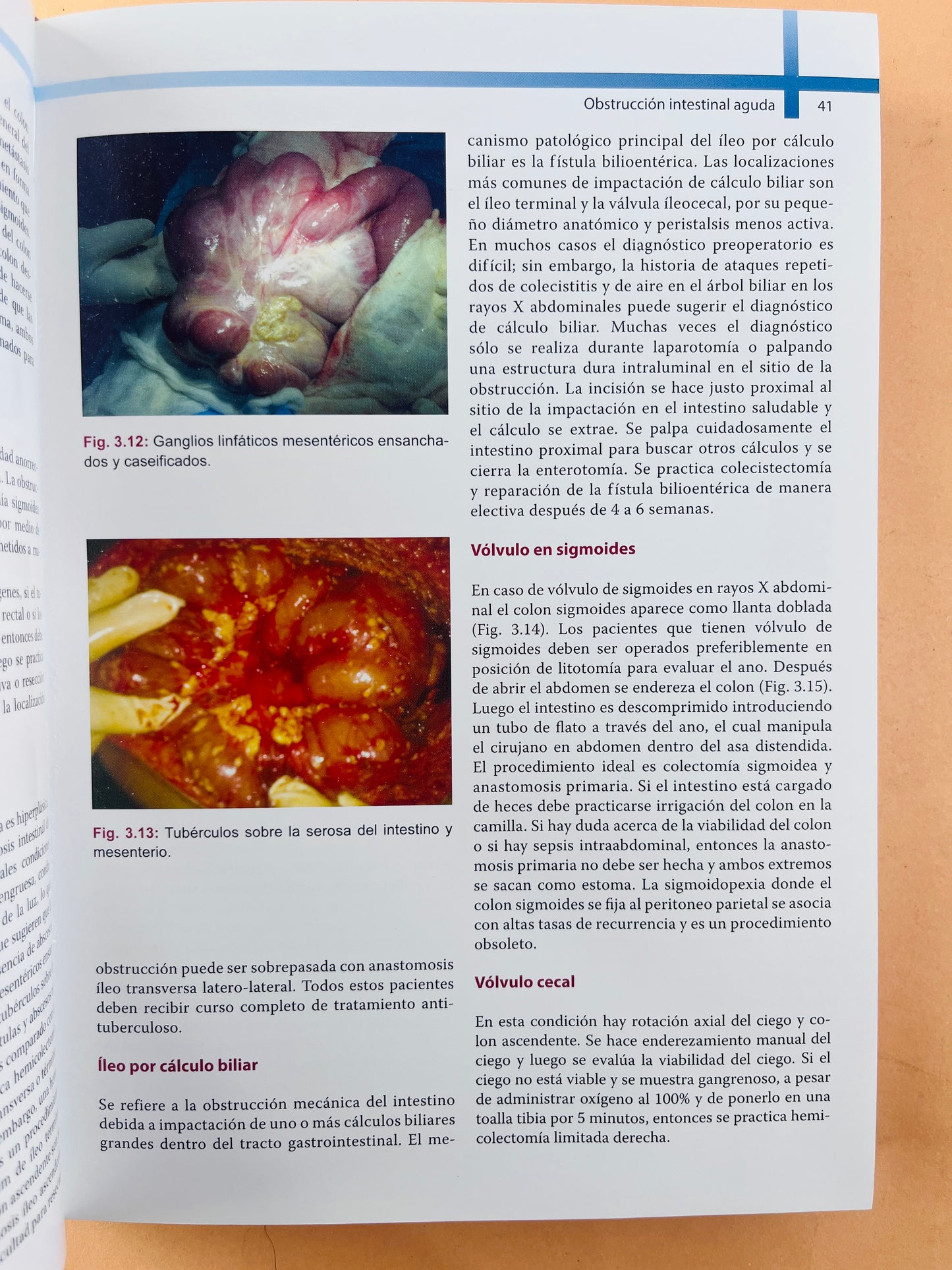 Abordaje en Emergencias Quirúrgicas