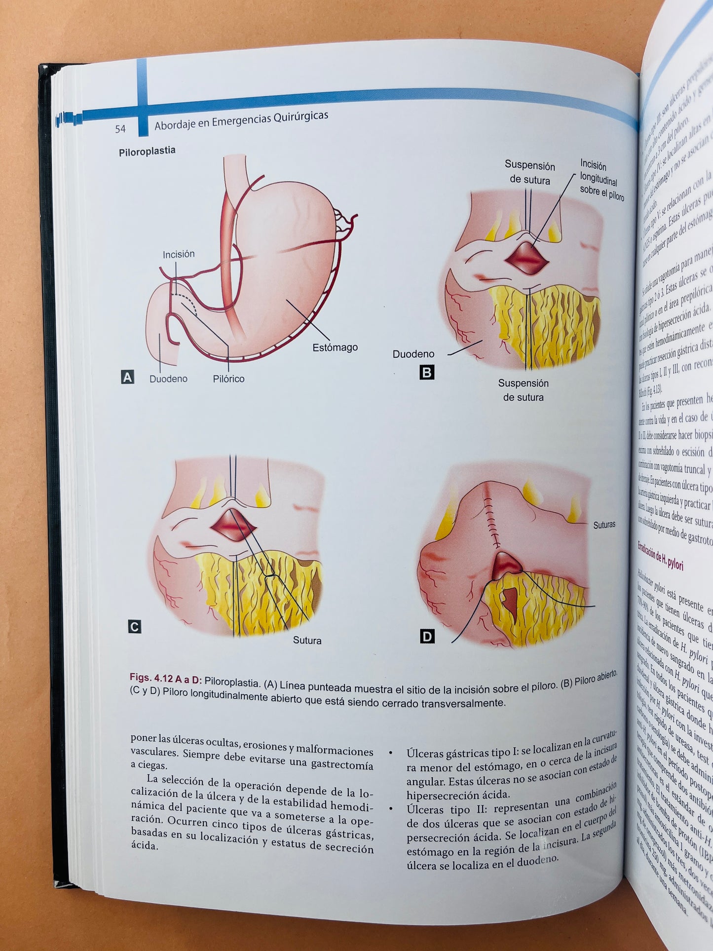 Abordaje en Emergencias Quirúrgicas