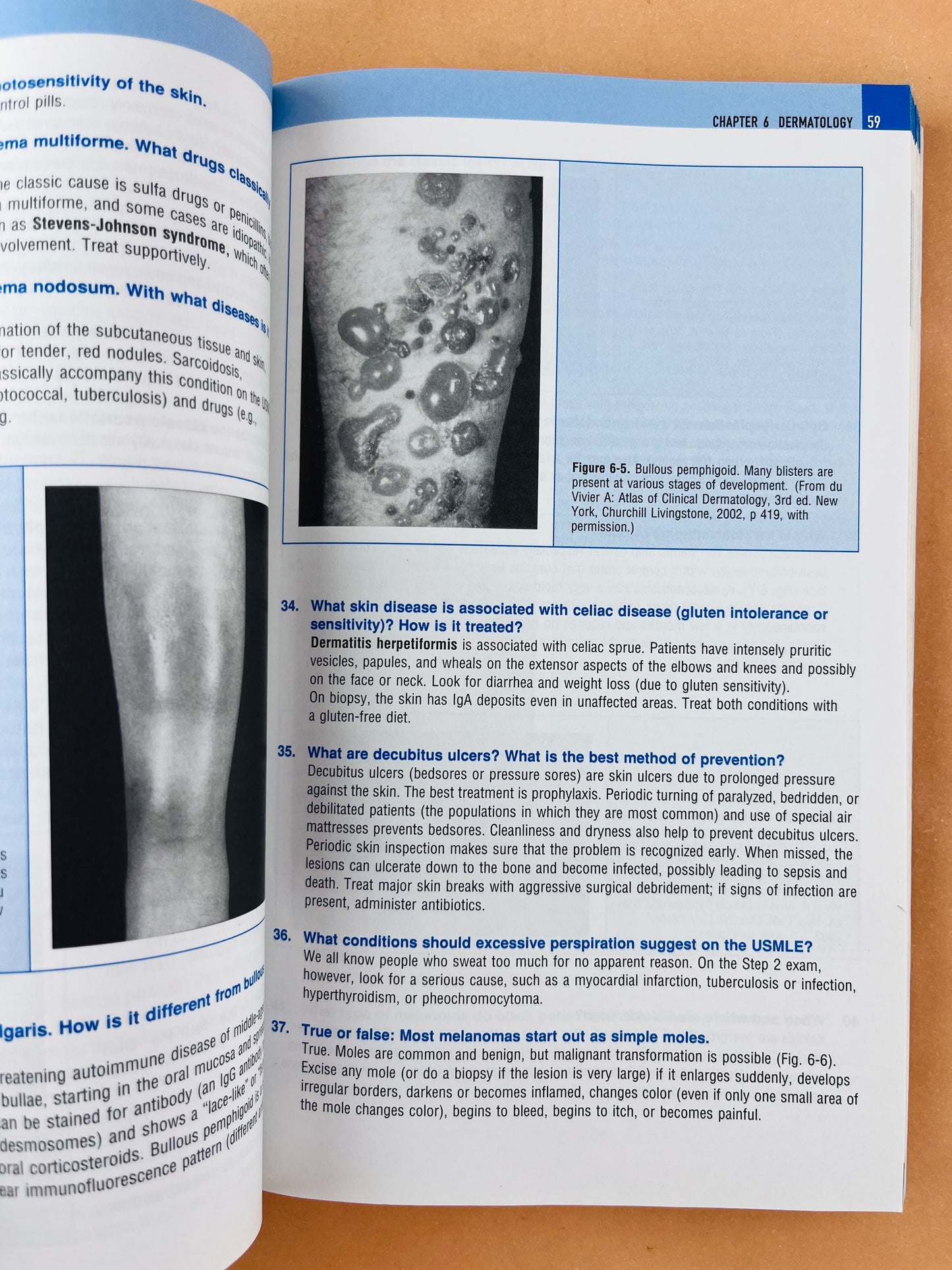 Usmle step 2 secrets third edition