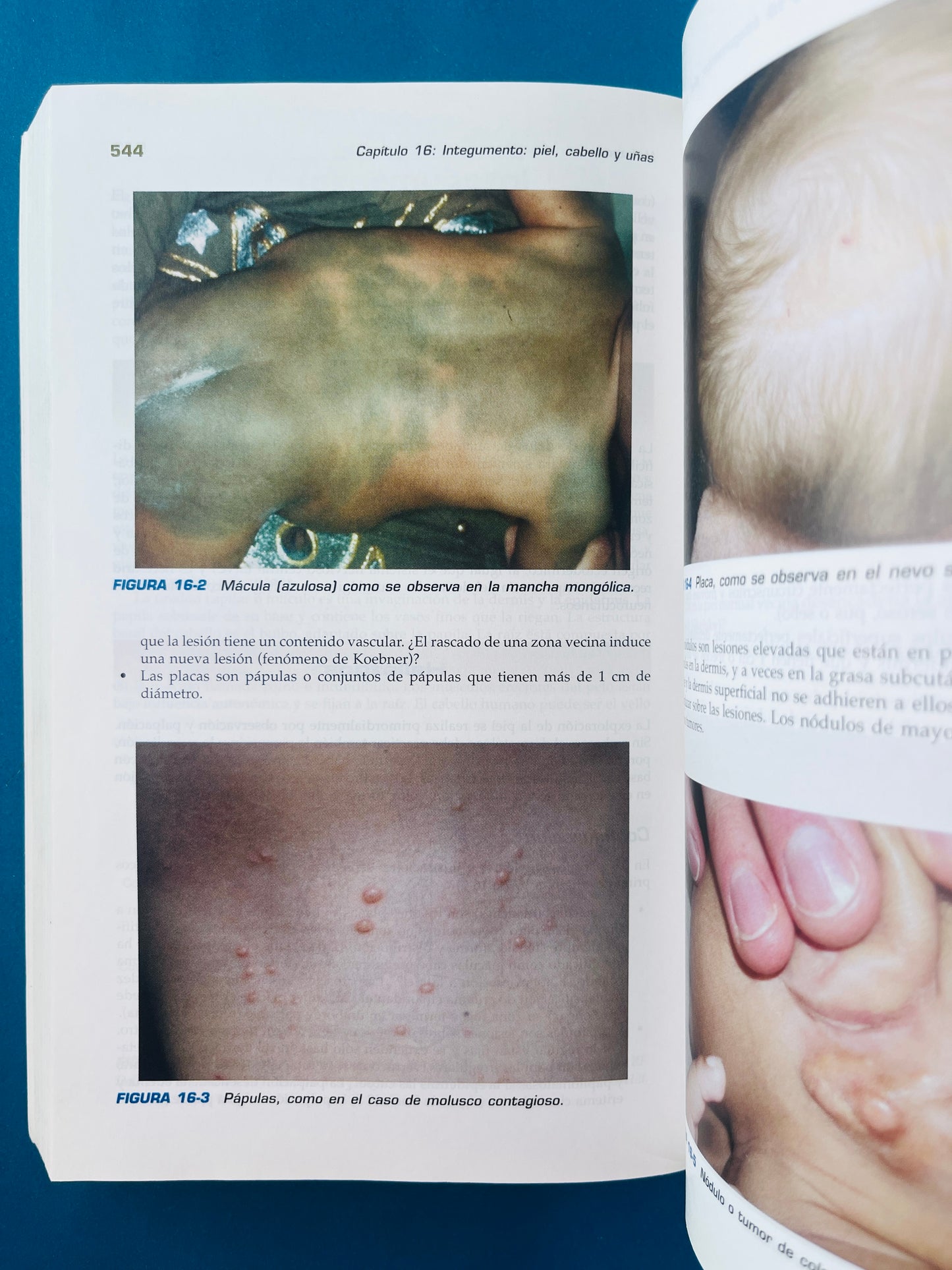 Examinación diagnóstica pediátrica