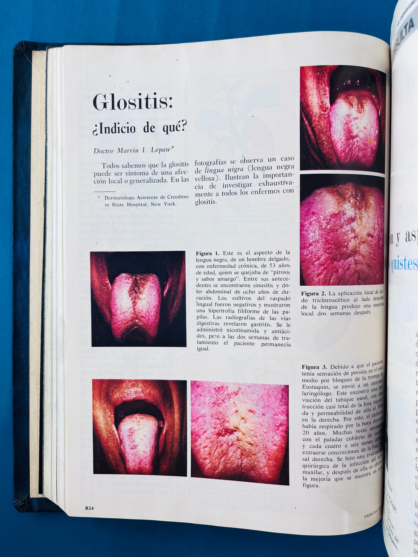 Enfermedades infecciosas Nobrium