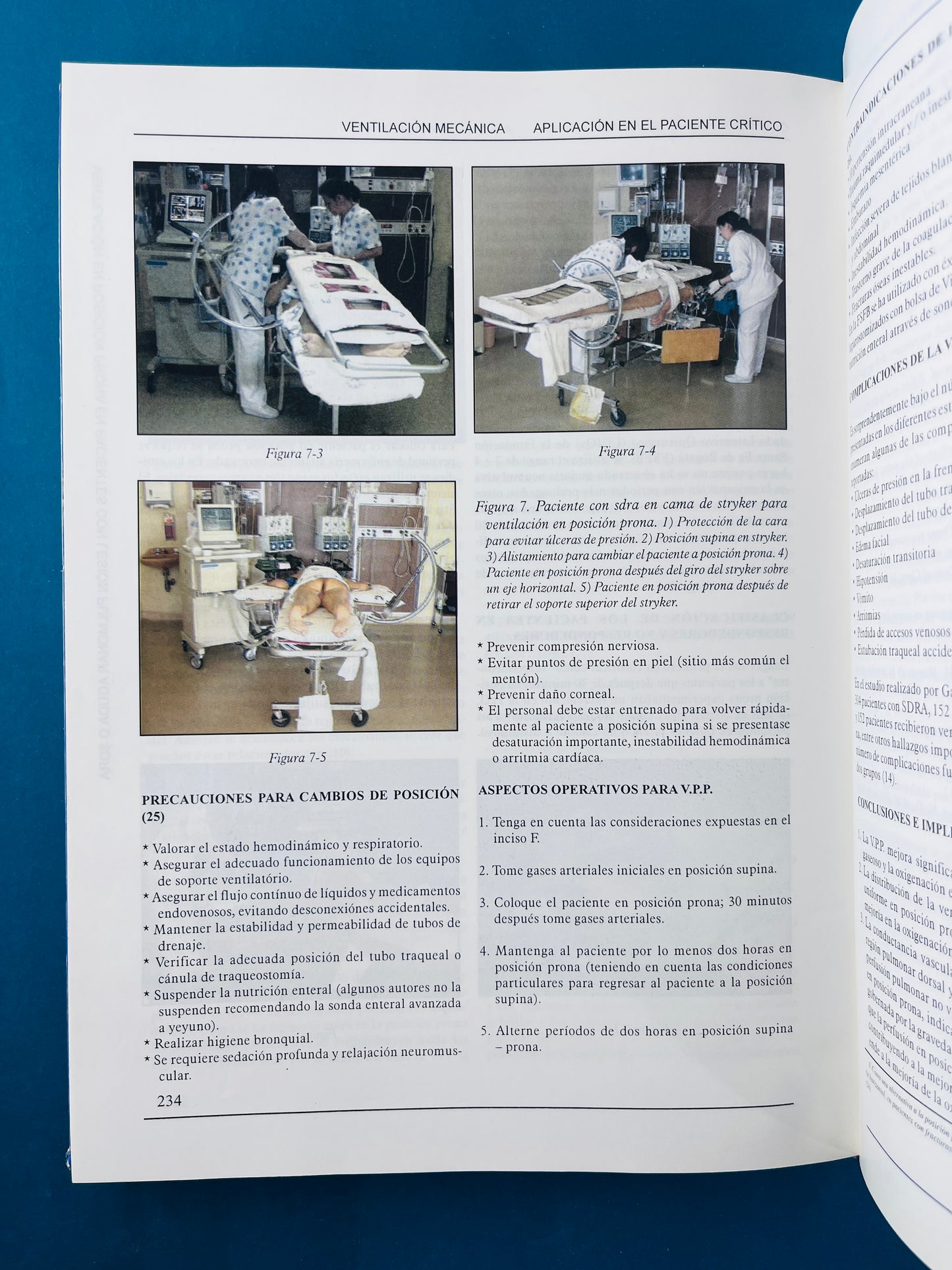 Ventilación mecánica Aplicación en el paciente crítico