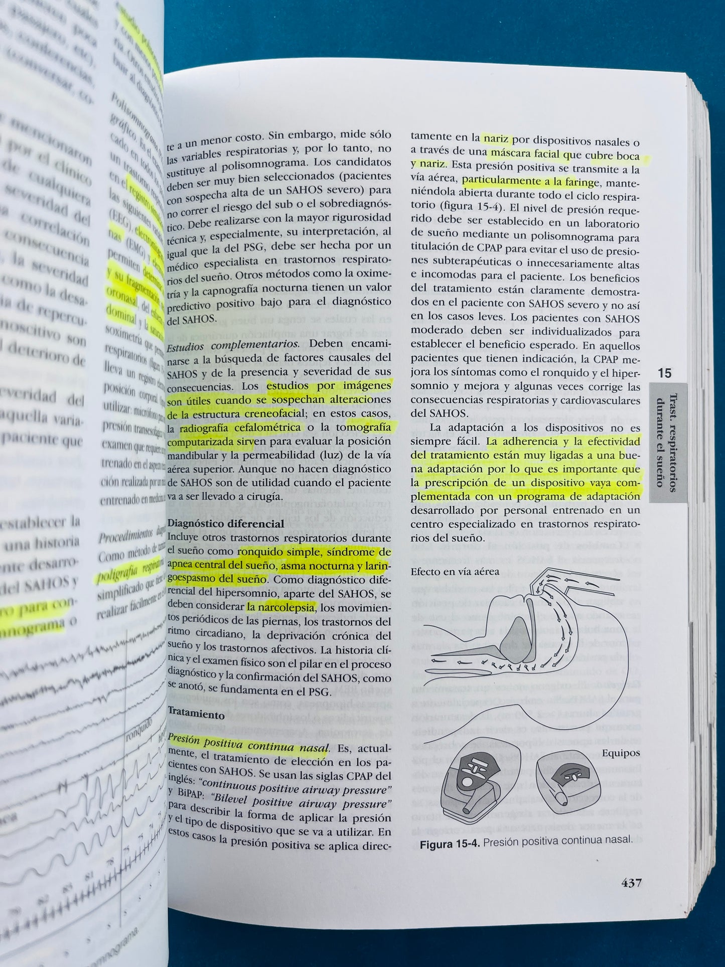 Fundamentos de medicina Neumologia sexta edición