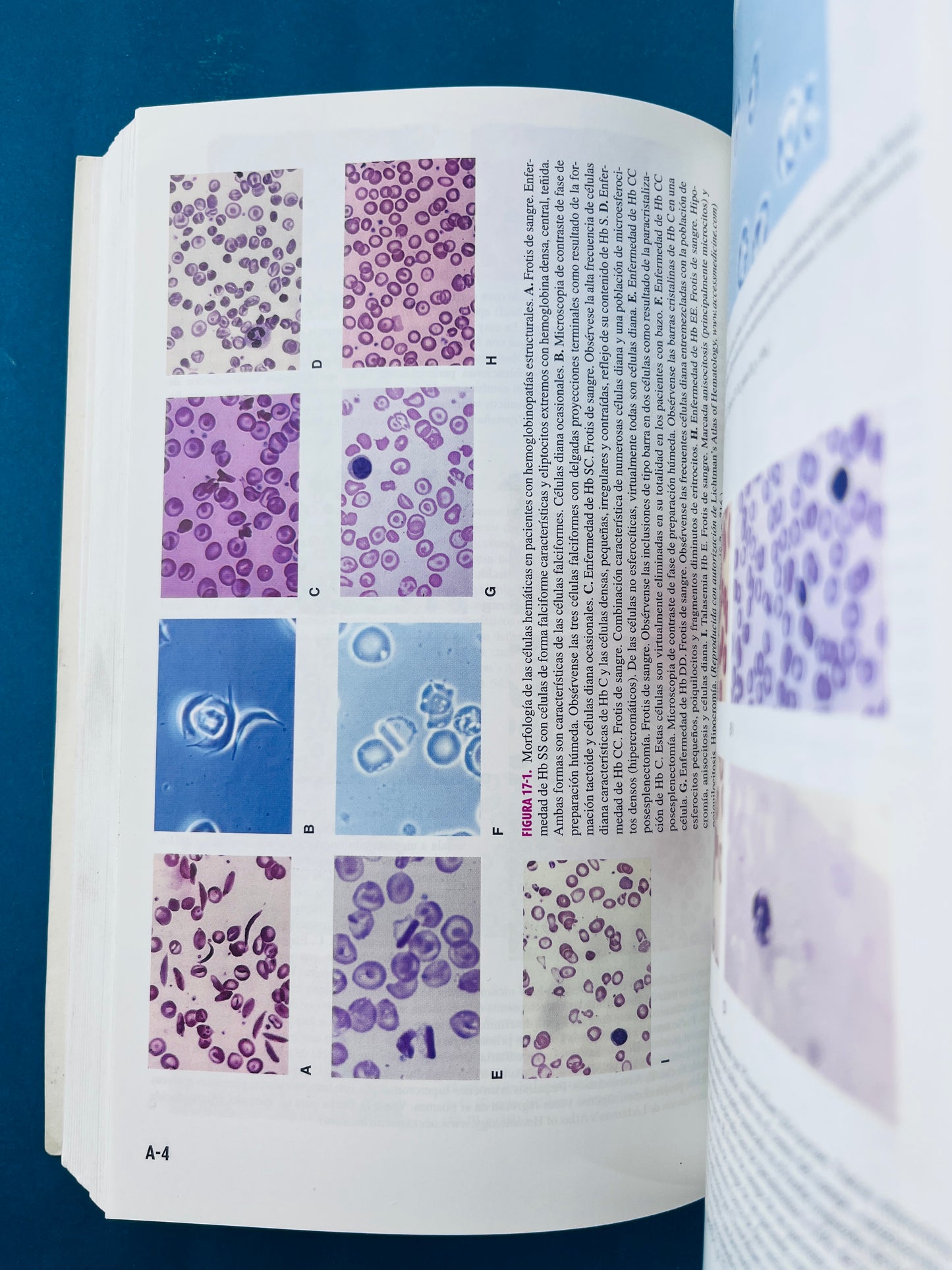 Williams manual de hematología octava edición