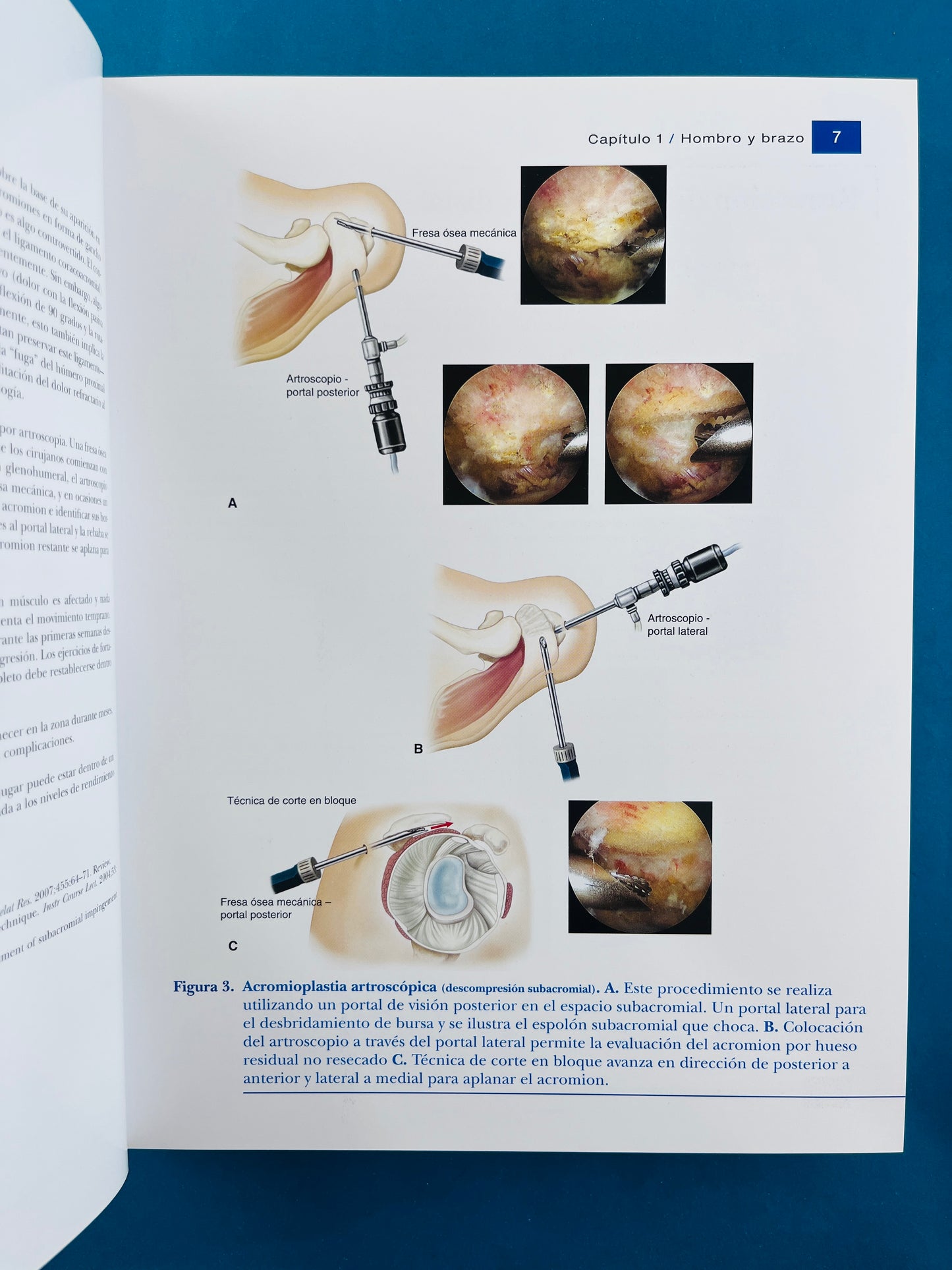 Condiciones de medicina deportiva reconocimiento, tratamiento planificación