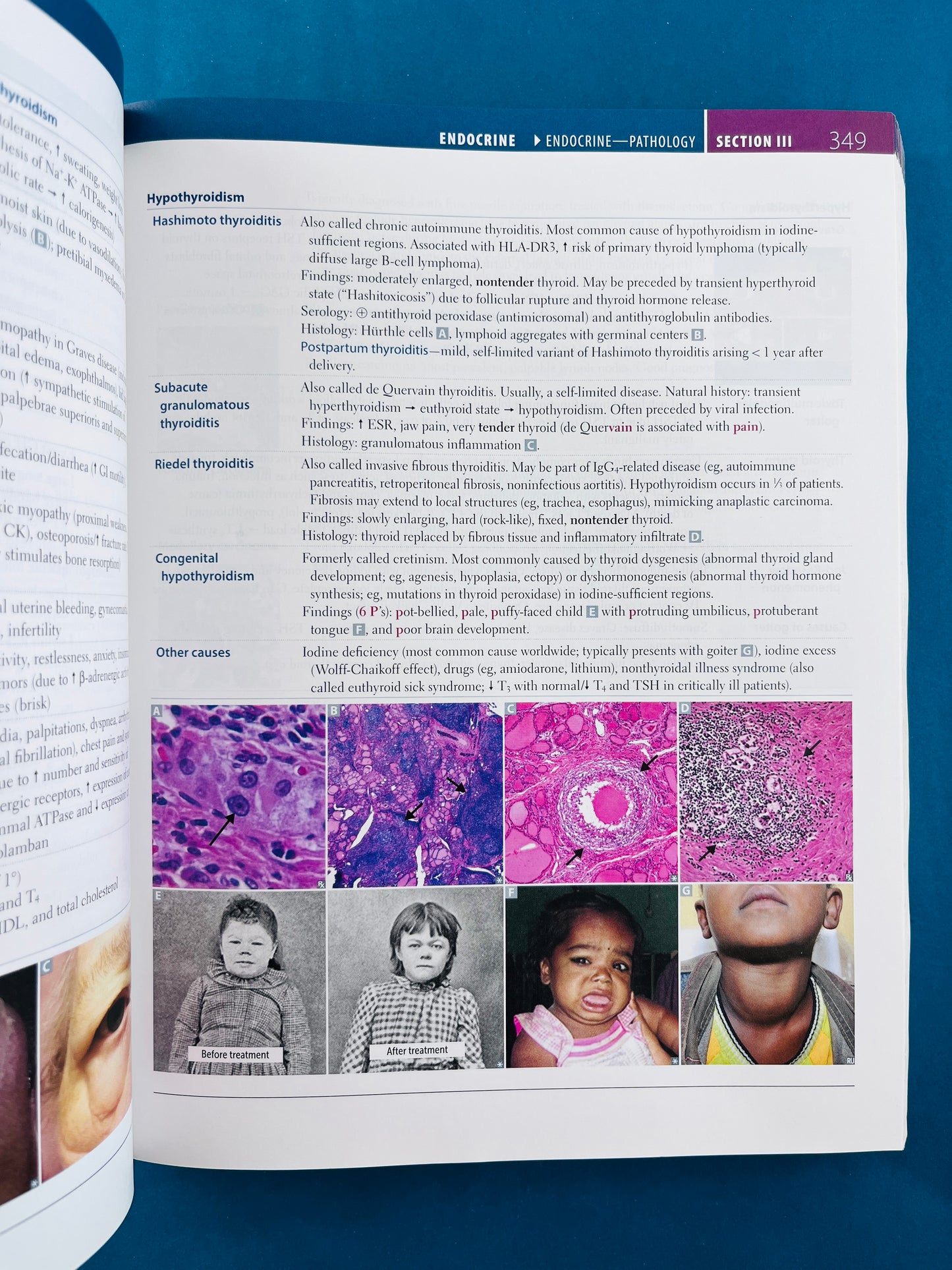 First aid for the usmle step 1 2021