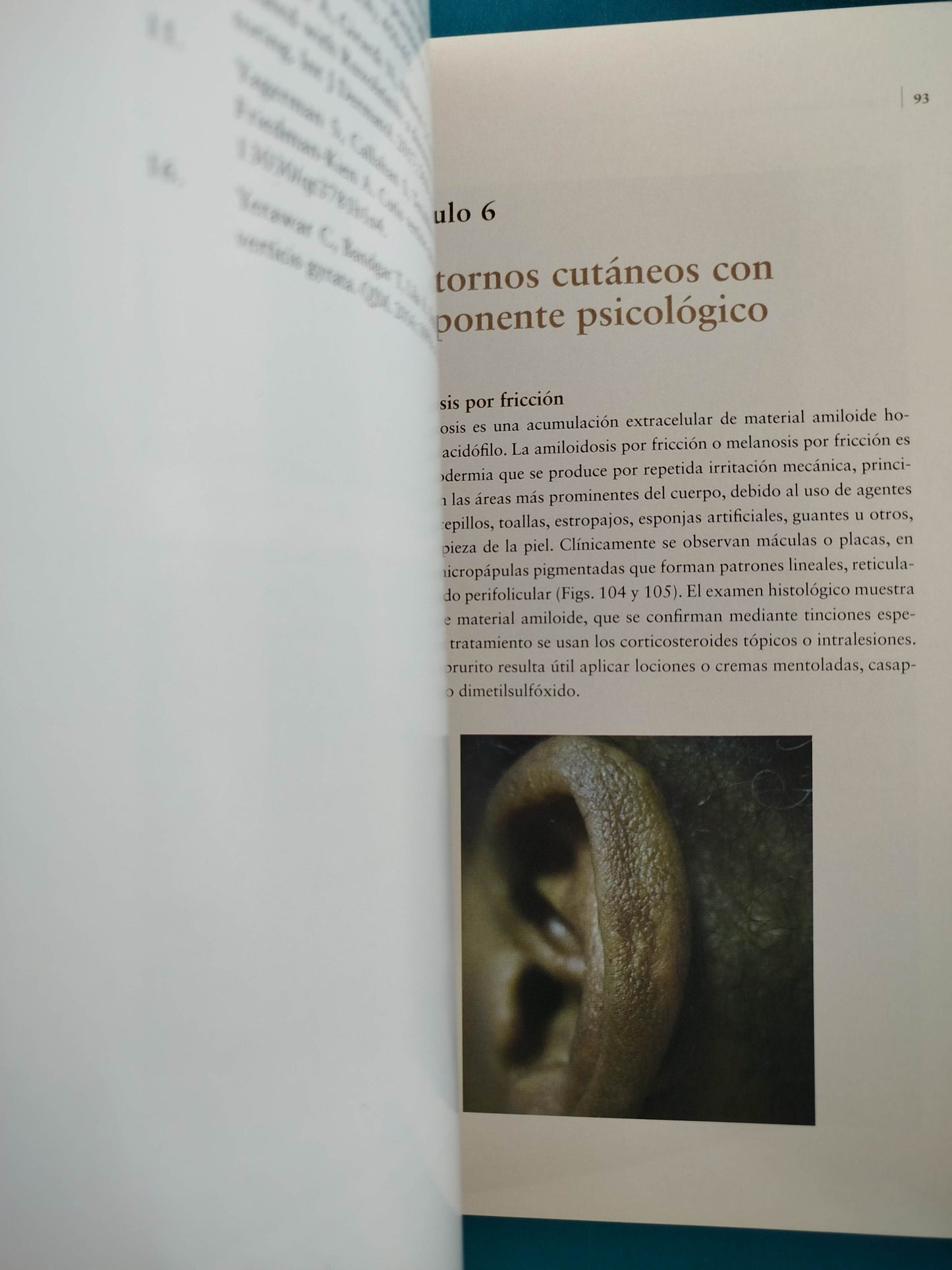 Atlas de dermatología clínica pieles oscuras