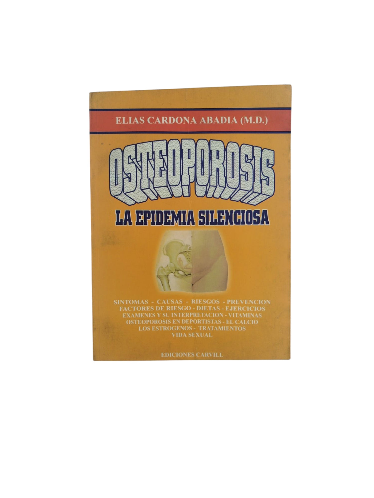 Osteoporosis - La Epidemia Silenciosa by Elias Cardona Abadia