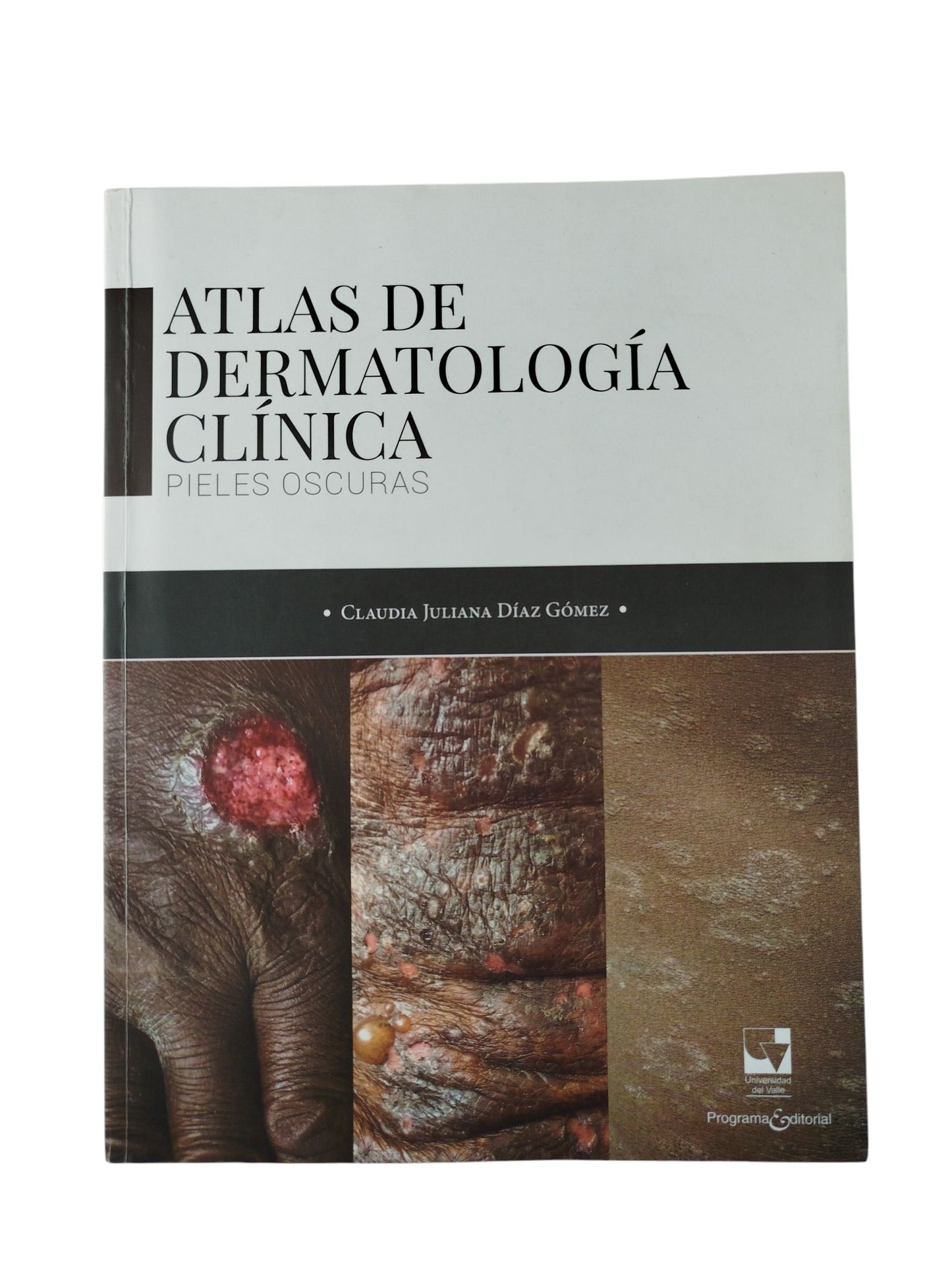 Atlas de dermatología clínica pieles oscuras