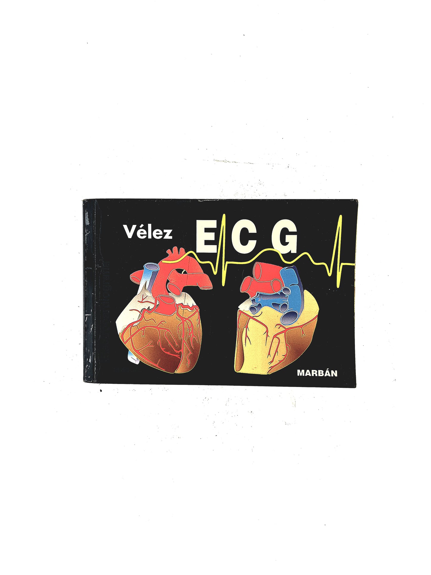Pautas en eléctrocardiograma ECG