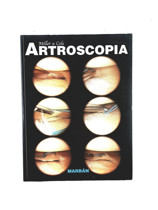 Artroscopia