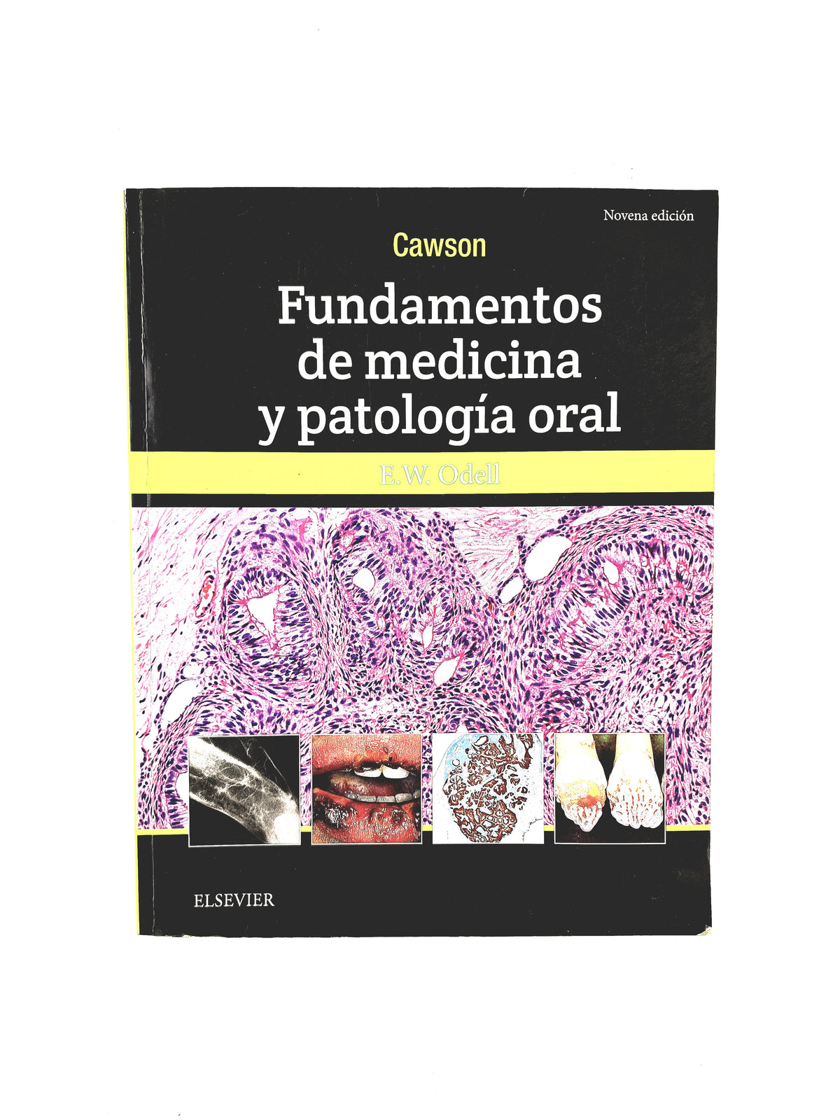 Cawson Fundamentos de Medicina y Patología Oral novena edición by E.W. Odell