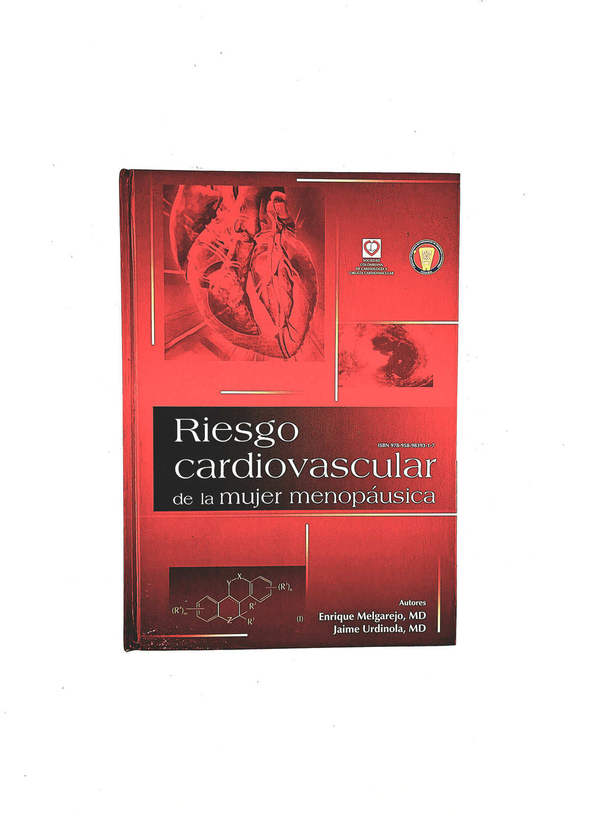 Riesgo cardiovascular de la mujer menopáusica by Enrique Melgarejo Jaime Urdinola