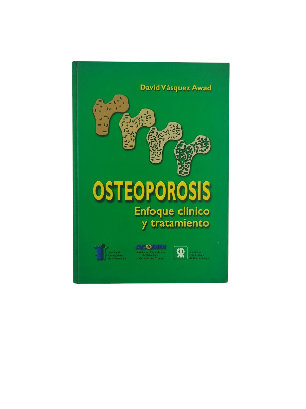 Osteoporosis enfoque clínico y tratamiento by David Vásquez Awad