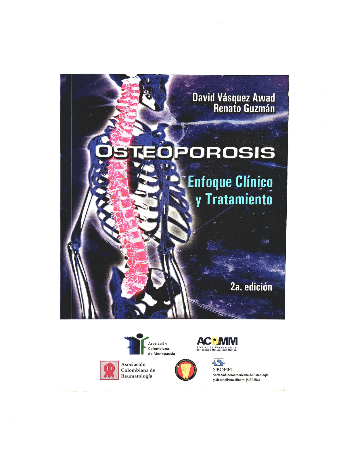 Osteoporosis enfoque clínico y tratamiento segunda edición by David Vasquez Awad Renato Guzmán