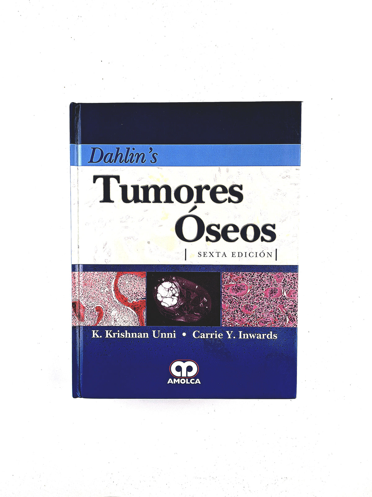 Dahlins Tumores Óseos aspectos y datos generales sobre 10165 casos sexta edición by K.Krishnan Unni Carrie Y. Inwards