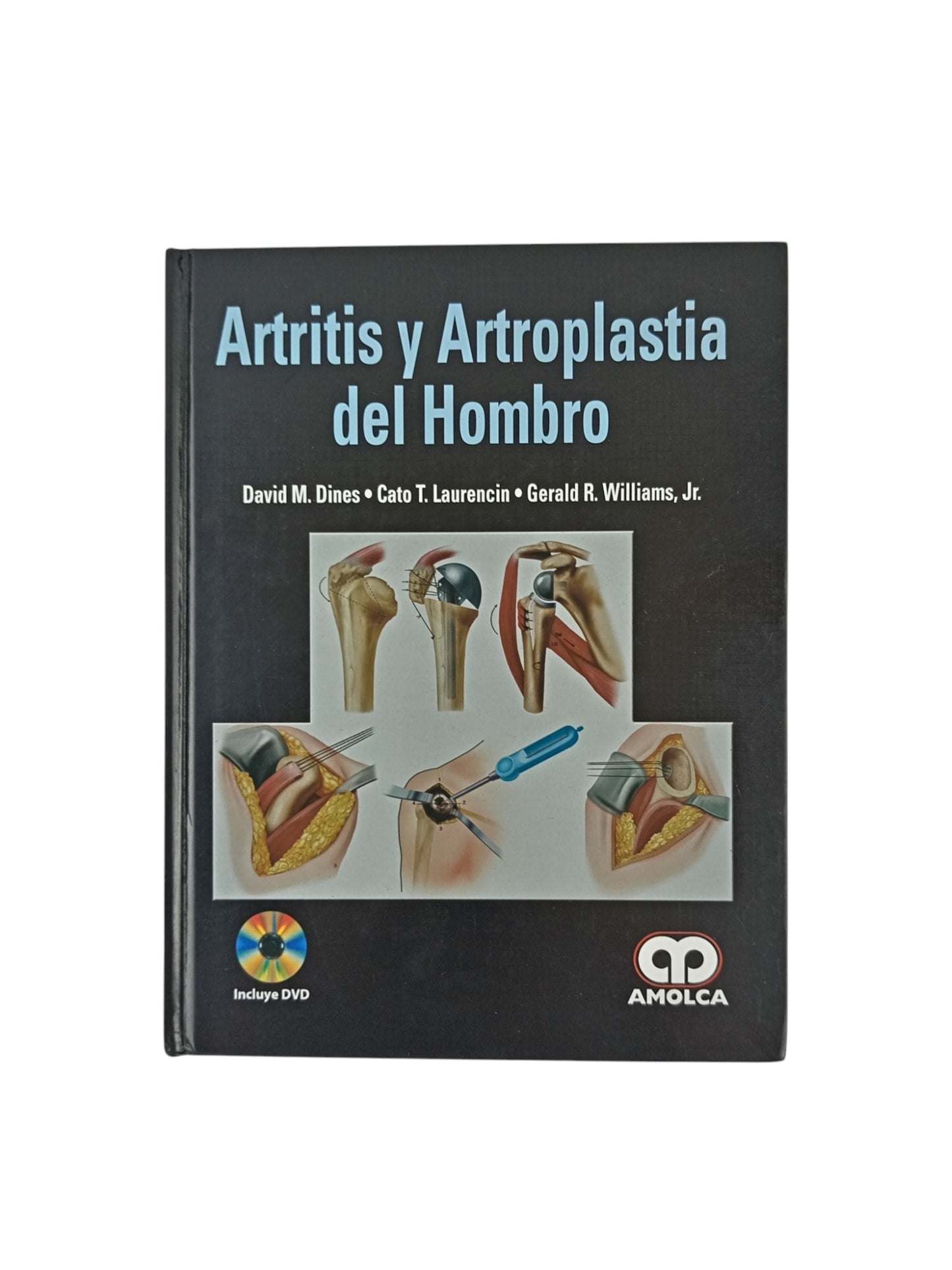 Artritis y artroplastia del hombro