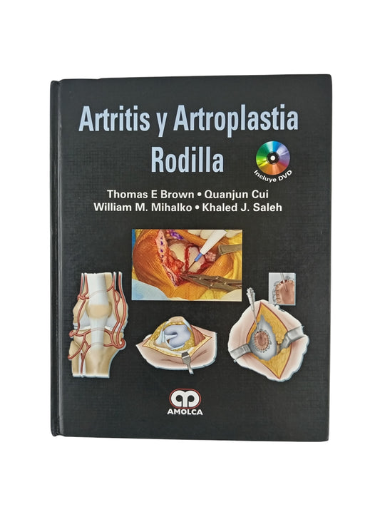 Artritis y artroplastia rodilla