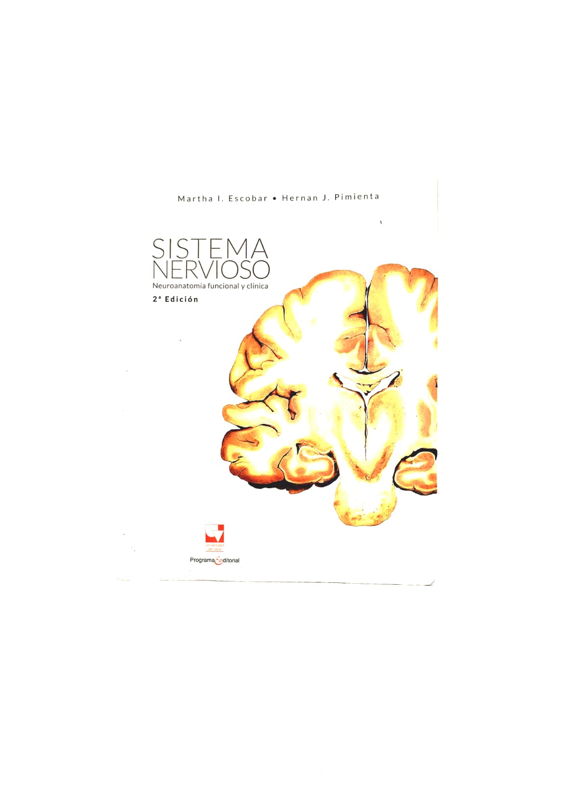 Sistema nervioso Neuroanatomía funcional y clínica