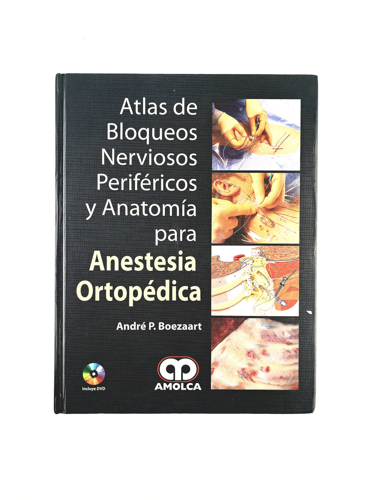 Atlas de Bloqueos Nerviosos Periféricos y Anatomía para Anestesia Ortopédica by André P. Boezaart