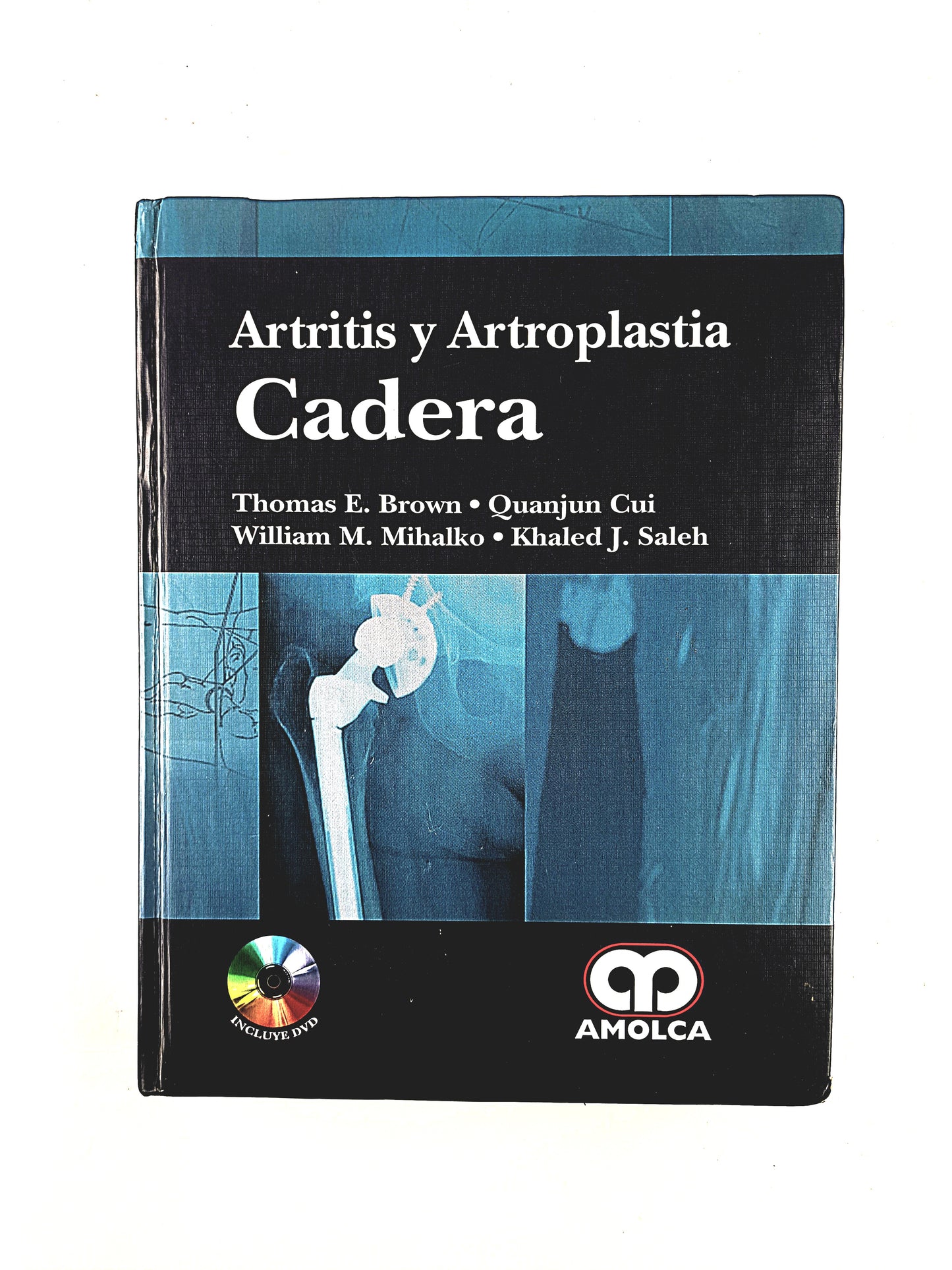 Artritis y Artroplastia Cadera