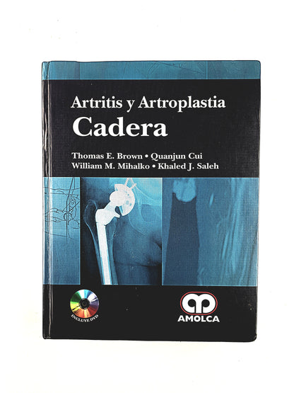 Artritis y Artroplastia Cadera