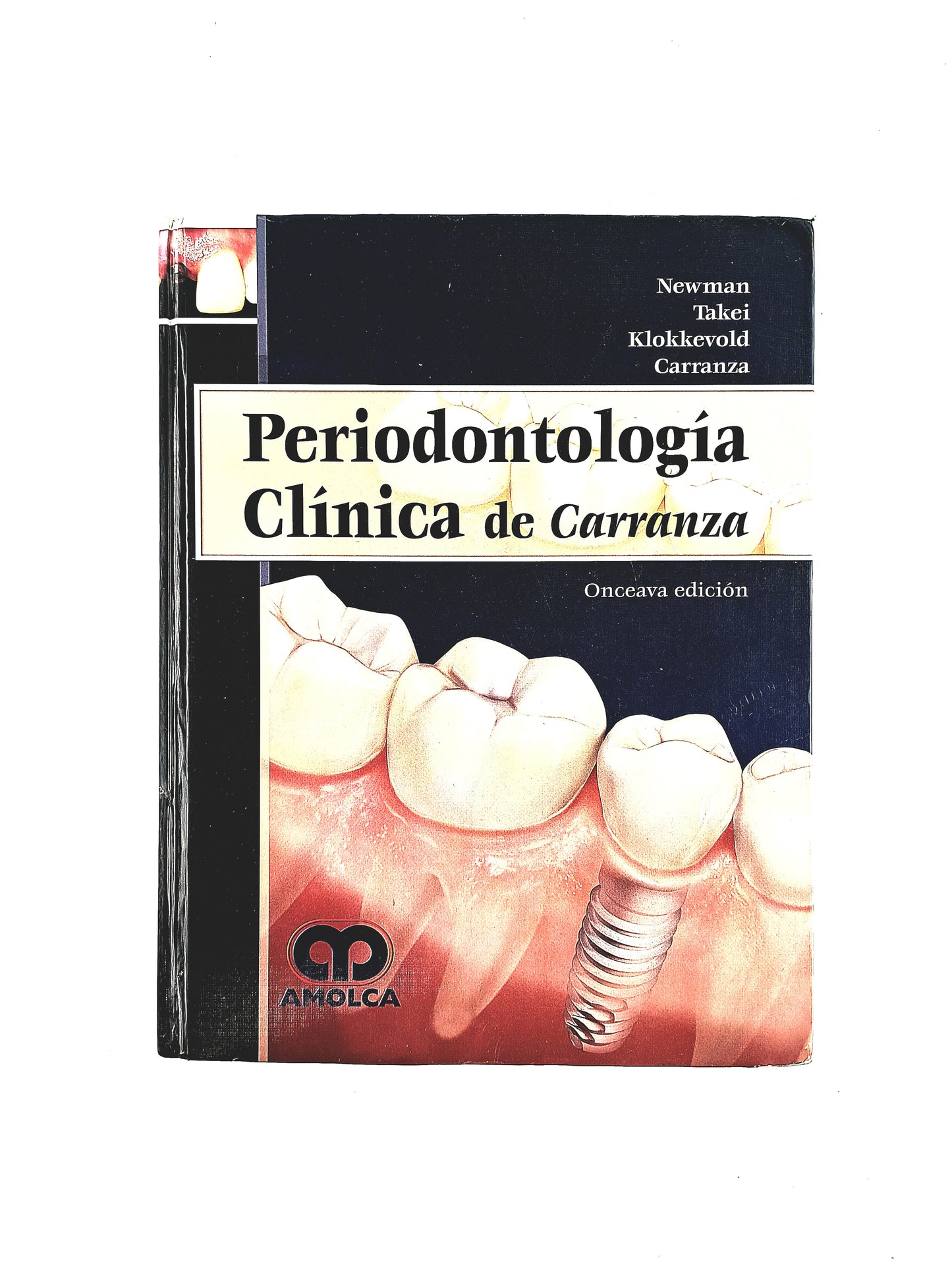 Periodontología Clínica de Carranza onceava edición