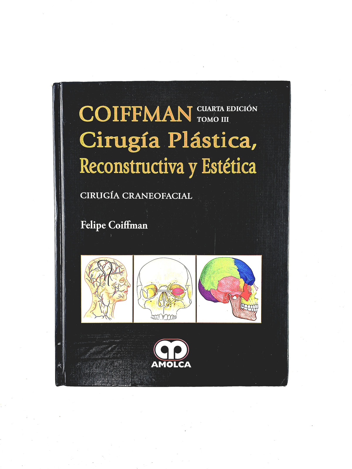 Cirugía plástica, reconstructiva y estética cirugía craneofacial cuarta edición tomo III by Felipe Coiffman