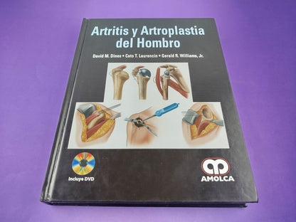 Artritis y artroplastia del hombro