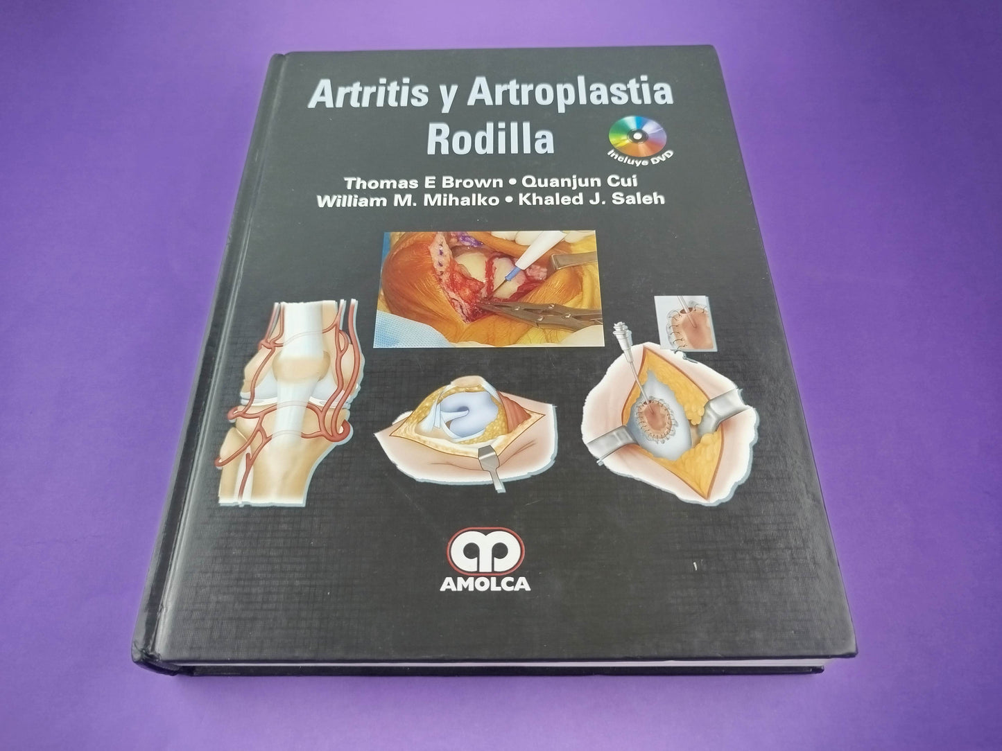 Artritis y artroplastia rodilla