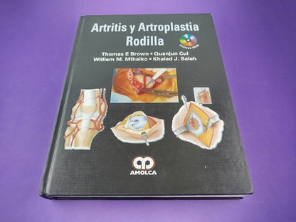 Artritis y artroplastia rodilla