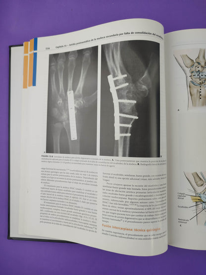 Muñeca diagnóstico y procedimientos quirúrgicos 2 edición volumen I Y II